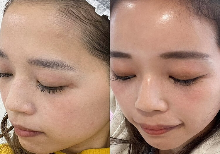 肌質改善スキンケア